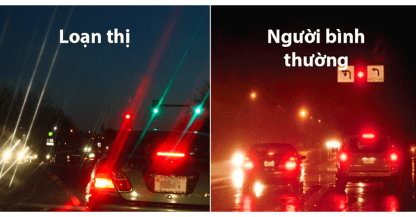 Mô tả hình ảnh nhìn bằng mắt giữa người bình thường và loạn thị