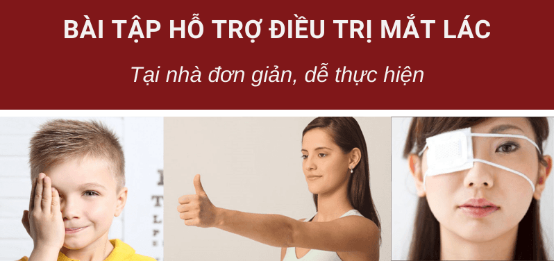 Luyện tập nhìn thẳng cho người mắt lác