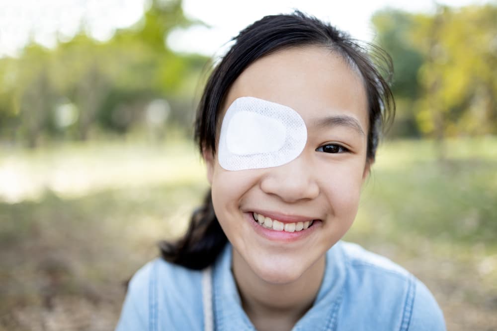 Mổ lác có tái phát không? Những lưu ý sau khi phẫu thuật mắt lác