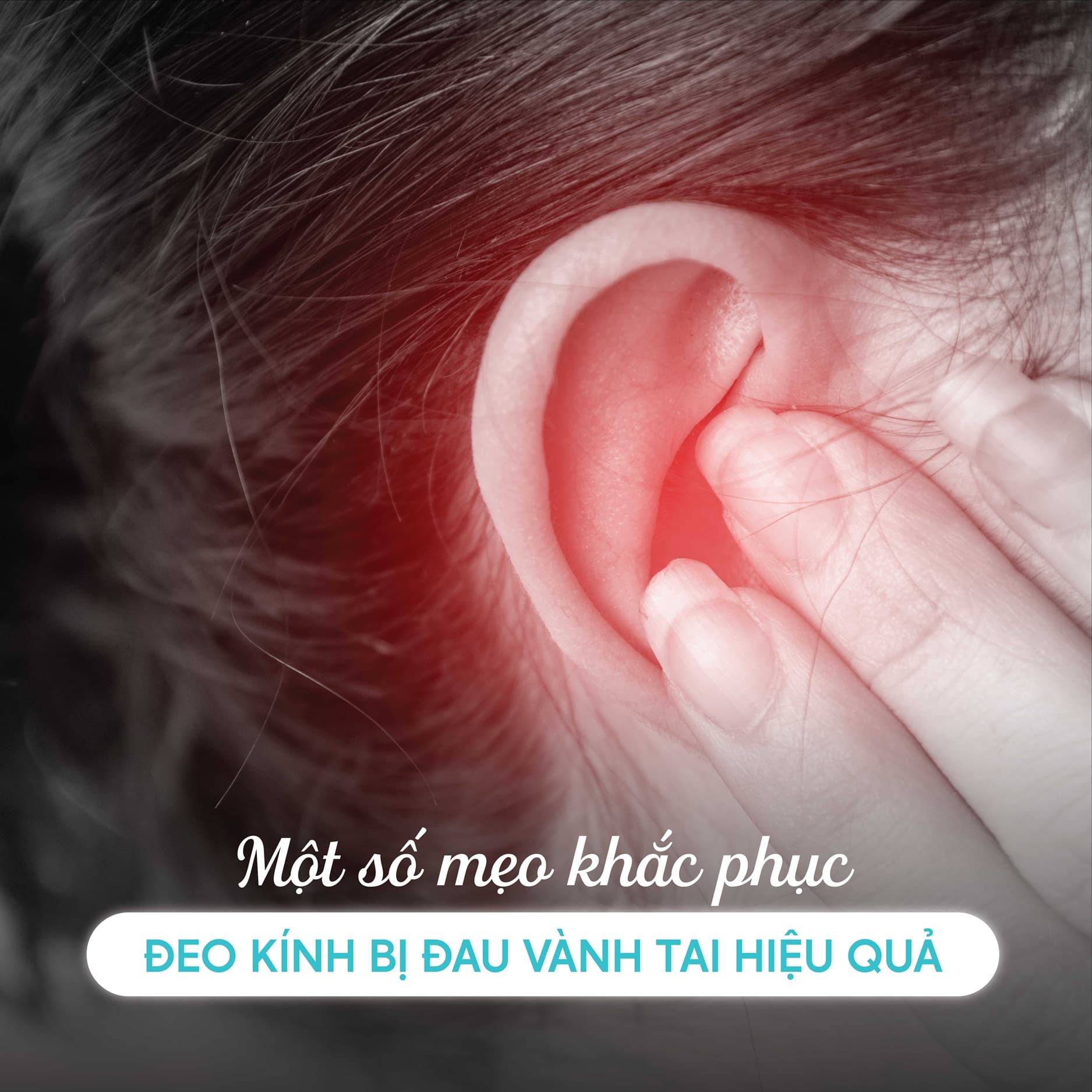 Một Số Mẹo Khắc Phục Đeo Kính Bị Đau Vành Tai Hiệu Quả